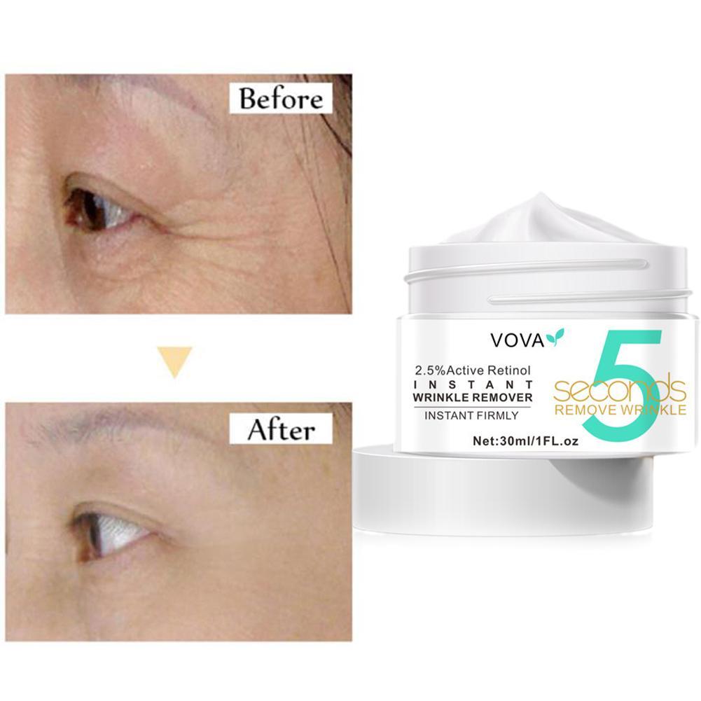 2.5% Active Retinol Eye Cream  - Milk Thistle Silymarin recension och pris