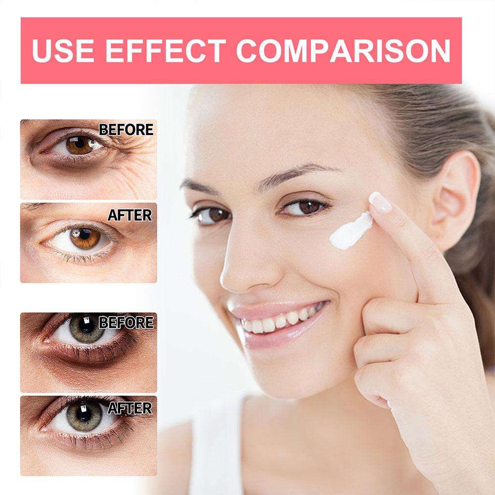 Retinol Eye Cream Lightening D - Milk Thistle Silymarin recension och pris