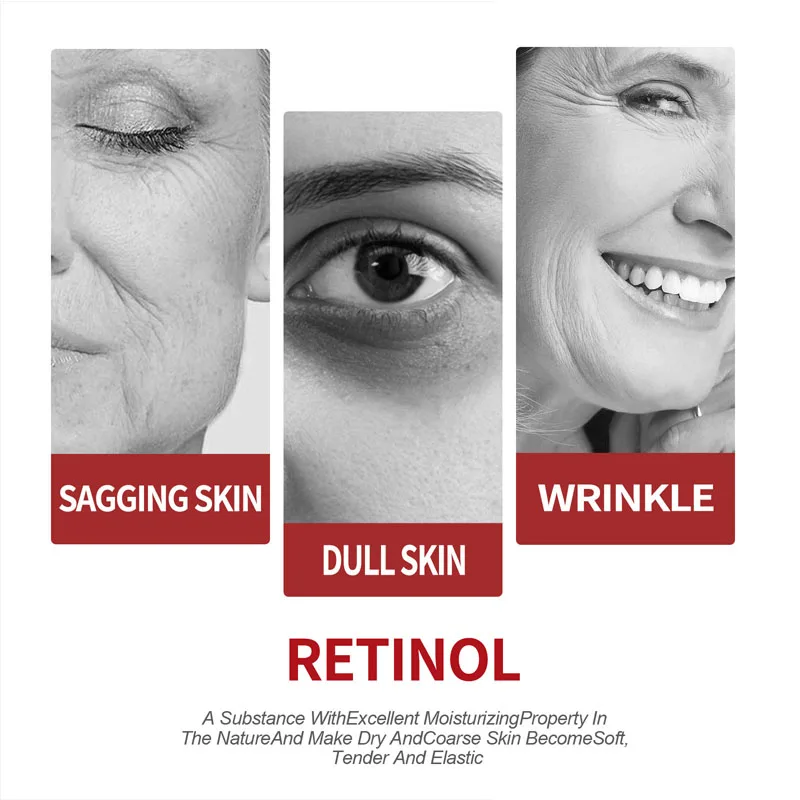 Retinol Cream  Moisturizing Sk - Milk Thistle Silymarin recension och pris